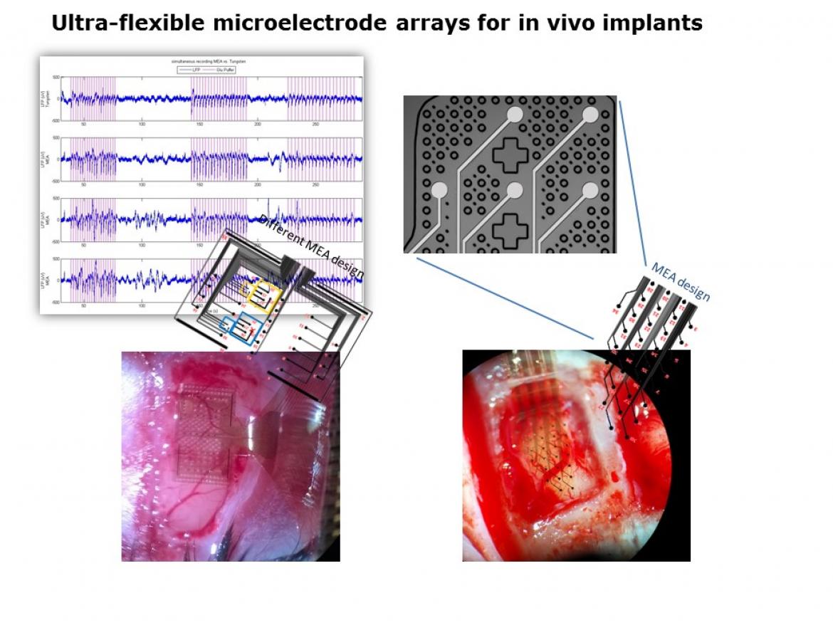 Wireless floating microelectrode array (WFMA) device before